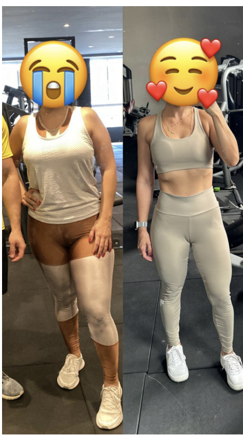 Antes e Depois 1